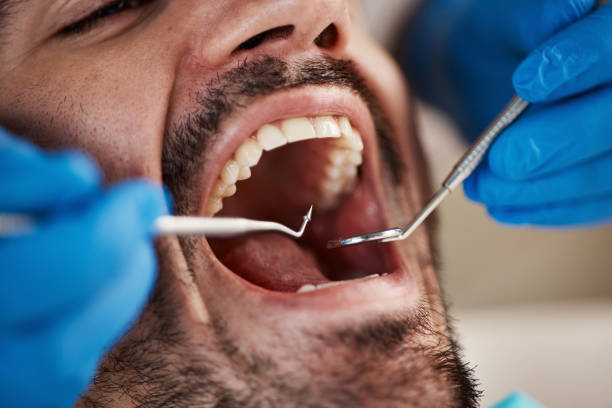 Best Urgent Tooth Repair  in Soh Weber, UT